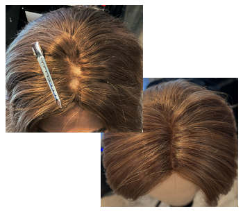 Before / After Hair System Repairs